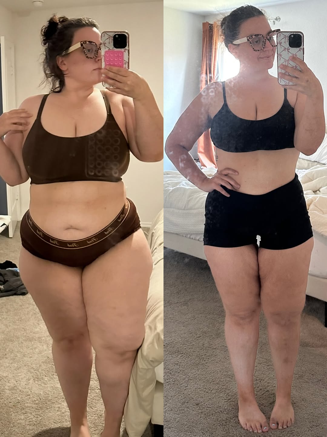 Before and after photos shared by a New Hope Weight Loss patient; individual results vary